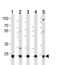 Anti-Ubiquitin