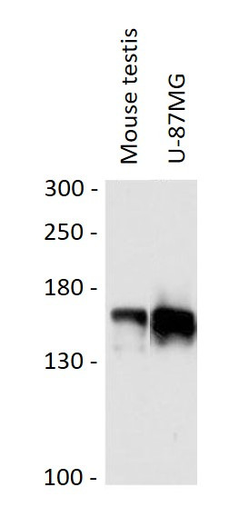 Anti-FMN1