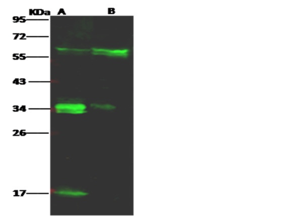 Anti-LFA-3/CD58 Monoclonal Recombinant Antibody