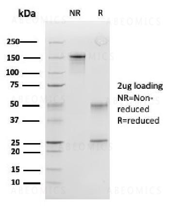 Anti-Peroxiredoxin 4 (Prognostic Marker for Lung SqCC) Monoclona Antibody (Clone: CPTC-PRDX4-2)