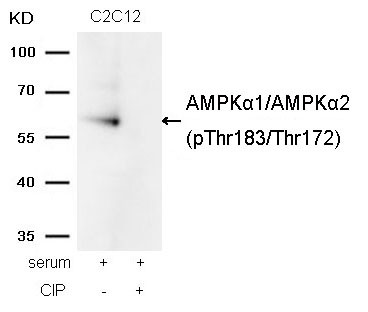 Anti-AMPK alpha 1 / AMPK alpha 2phospho (Thr183/Thr172)