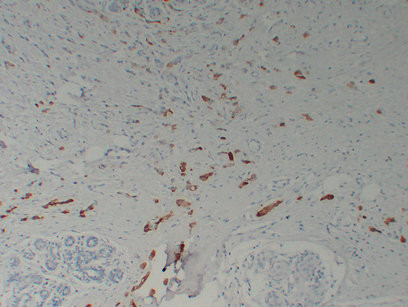 Anti-SCGB2A2 / Mammaglobin A