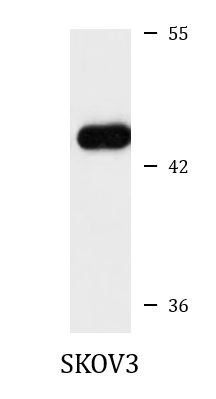 Anti-CDK9