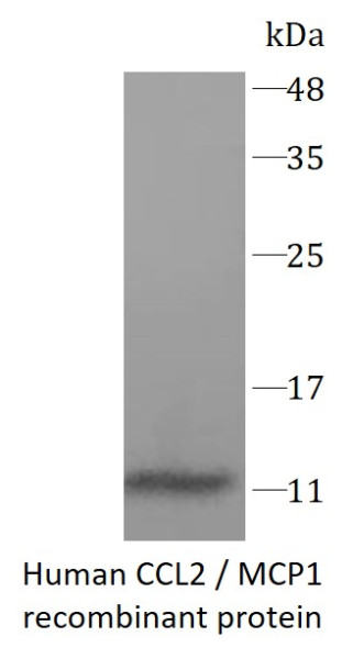 Human CCL2 / MCP1 recombinant protein (Active) (His-tagged)