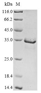 Mitogen-activated protein kinase kinase kinase 14 (MAP3K14), partial, human, recombinant