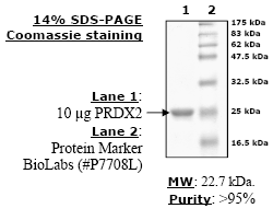 Peroxiredoxin II, active human recombinant protein
