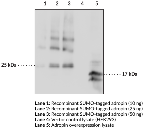 Anti-Adropin (Clone CC1133F5)