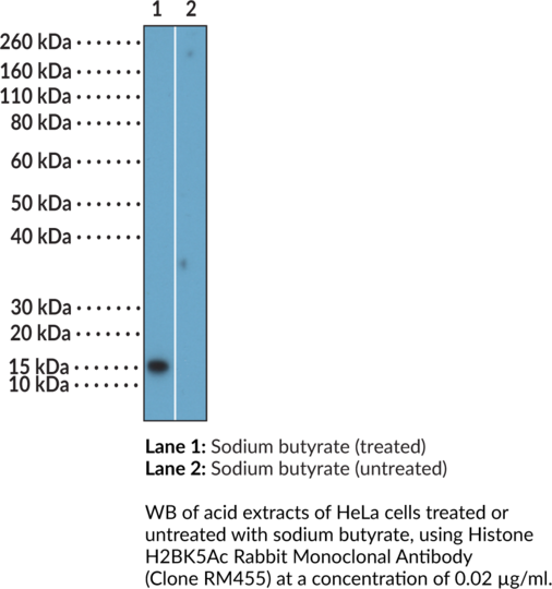 Anti-Histone H2BK5Ac Rabbit (Clone RM455)