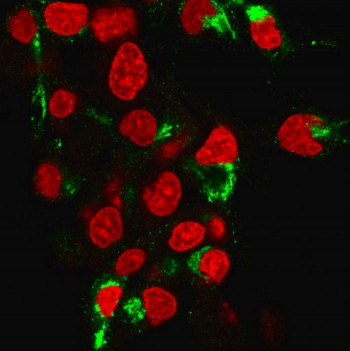 Anti-Albumin / ALB, clone ALB/2355