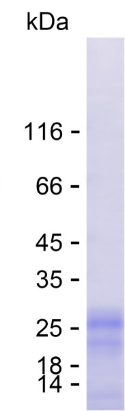 Recombinant Human IRAG1 Protein