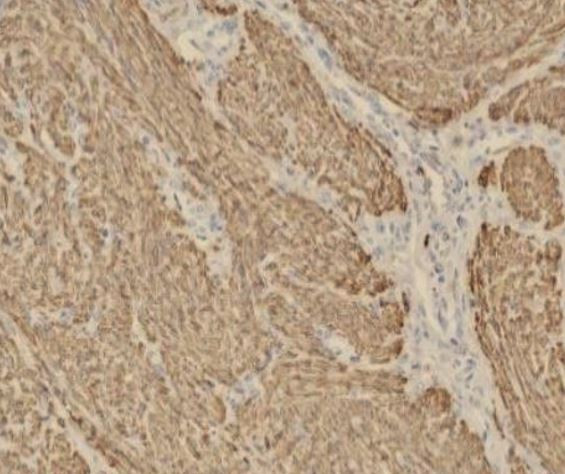 Anti-Calponin 1, clone SQab20187