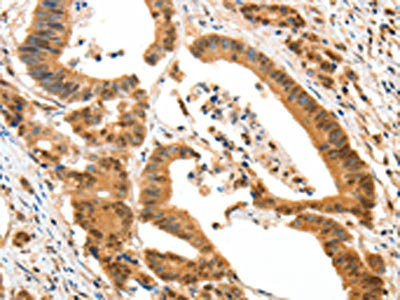 Anti-HTR3A