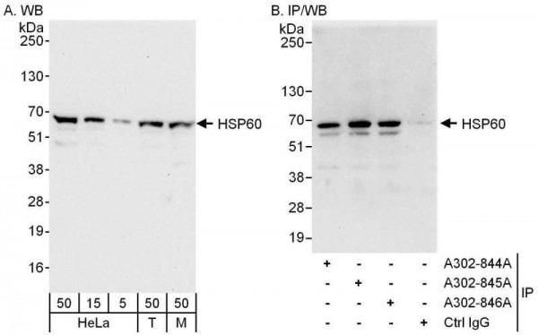 Anti-HSP60