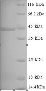 Lysyl endopeptidase (prpL), Pseudomonas aeruginosa, recombinant