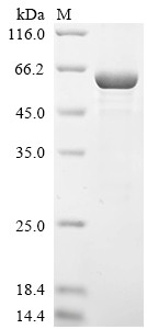 Galectin-3-binding protein (LGALS3BP), human, recombinant