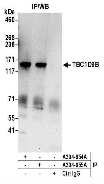 Anti-TBC1D9B