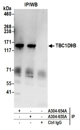 Anti-TBC1D9B