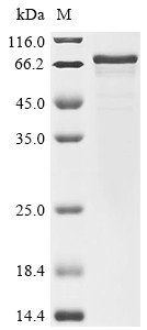 Regulator of G-protein signaling 14 (Rgs14), mouse, recombinant