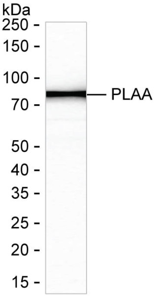 Anti-Phospholipase A2 Activator Protein