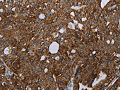 Anti-HMGCR