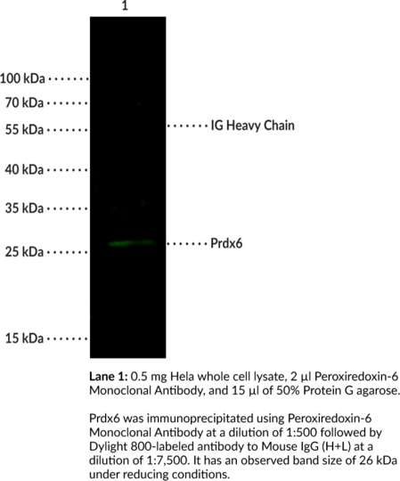 Anti-Peroxiredoxin-6 (Clone 03)