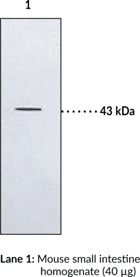 Anti-BLT2 Receptor