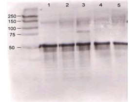 Anti-Angiopoietin-1 (Ang-1, TIE1, Tunica Internal Endothelial Cell Kinase)