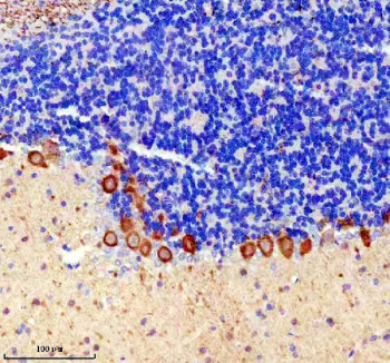 Anti-PRKCG / Protein kinase C gamma, clone 19P37