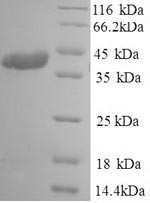 Spike glycoprotein (S), partial, human coronavirus OC43, recombinant