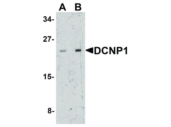 Anti-DCNP1