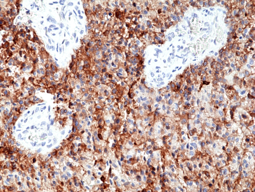 Anti-EGFRvIII (human), Rabbit Monoclonal (RM419) (Biotin)