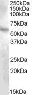 Anti-DMP1, Internal