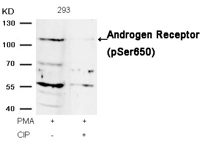 Anti-phospho-Androgen Receptor (Ser650)