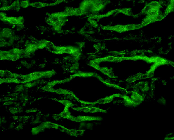 Anti-Aquaporin 4