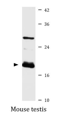 Anti-FTMT / Mitochondrial Ferritin