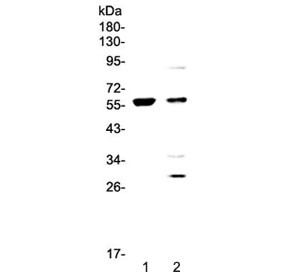 Anti-PDK1 / Pyruvate Dehydrogenase Kinase 1