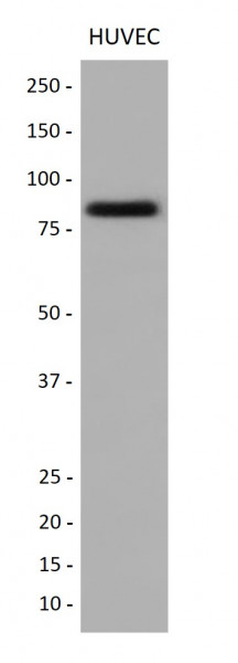 Anti-CD105 / Endoglin