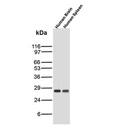 Anti-p27 / p27Kip1, clone r1B4
