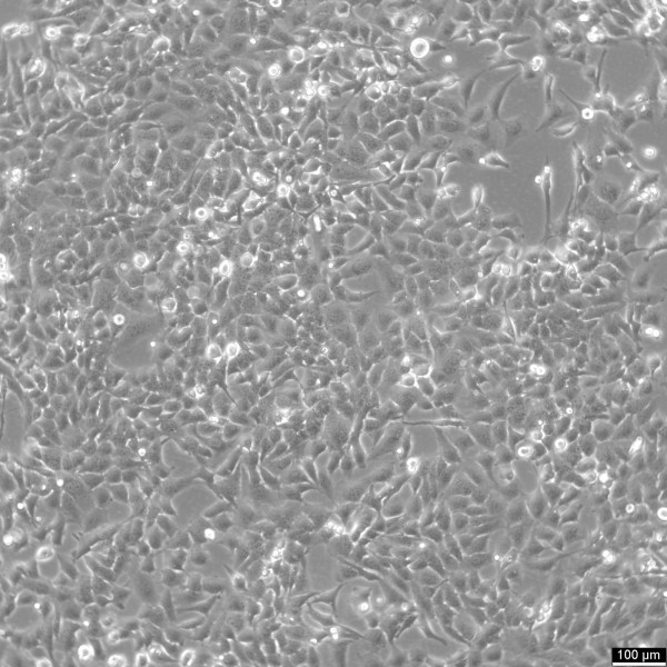 TTA1 Cells