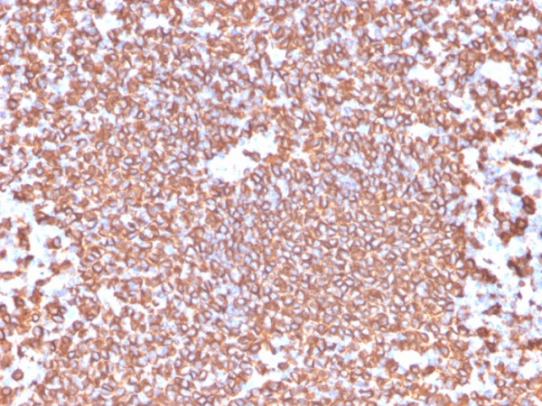 Anti-CD20 / MS4A1 (B-Cell Marker), recombinant antibody, clone IGEL/4524R