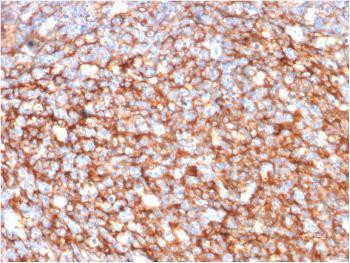 Anti-CD73 (Immuno-Oncology Target) Monoclonal Antibody (Clone: NT5E/2646)