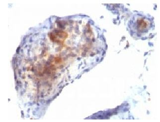 Anti-FOXP3, clone FXP3/197