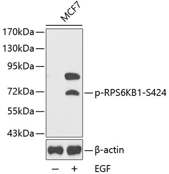 Anti-phospho-RPS6KB1-S424