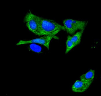 Anti-ATP11C