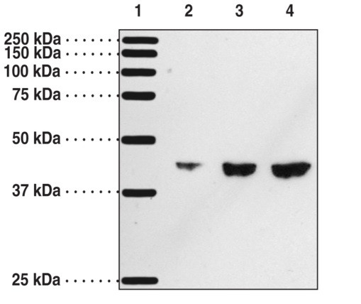 Anti-DP1 Receptor