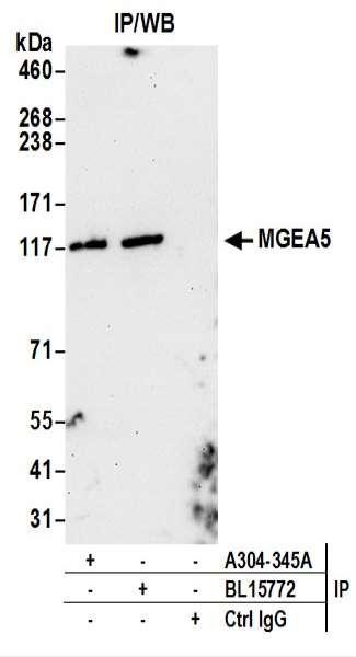 Anti-MGEA5