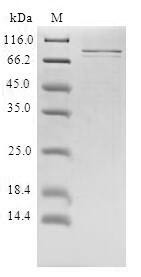Prolactin receptor (PRLR), human, recombinant