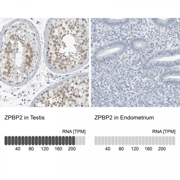 Anti-ZPBP2