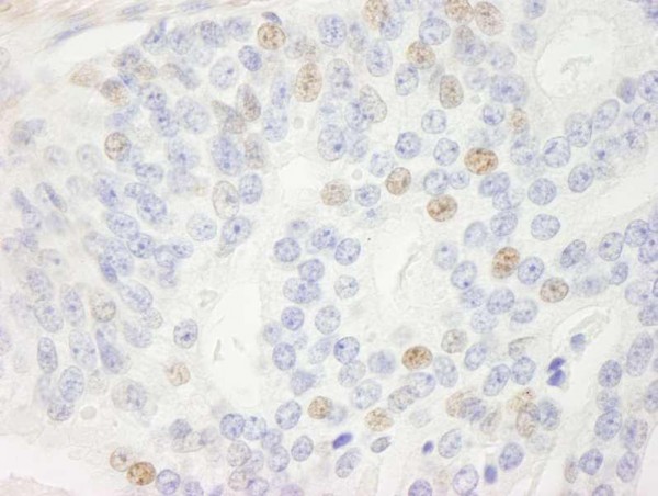 Anti-p14ARF (IHC)