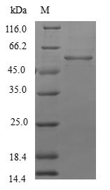 Beta-1,3-N-acetylglucosaminyltransferase lunatic fringe (LFNG), human, recombinant